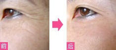 三院美容