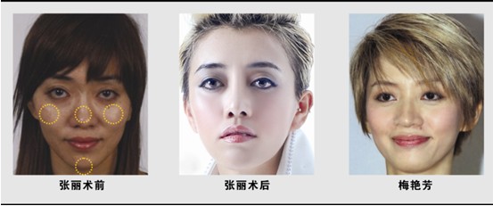 徐州美莱整形